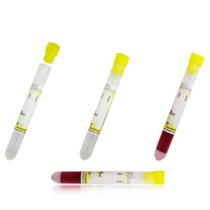 لوله بدون خلاء خونگیری 5ml
